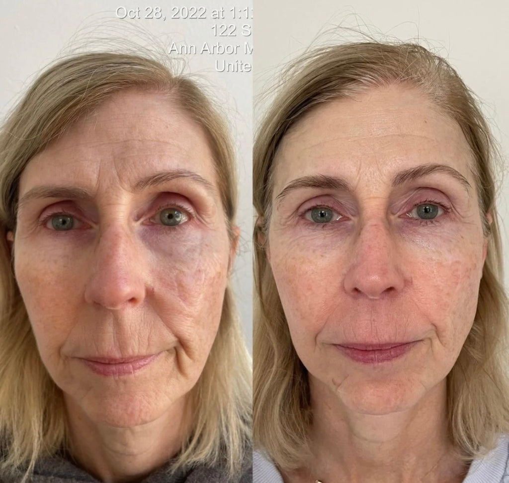 KrX Youthplex Face Lift Serum