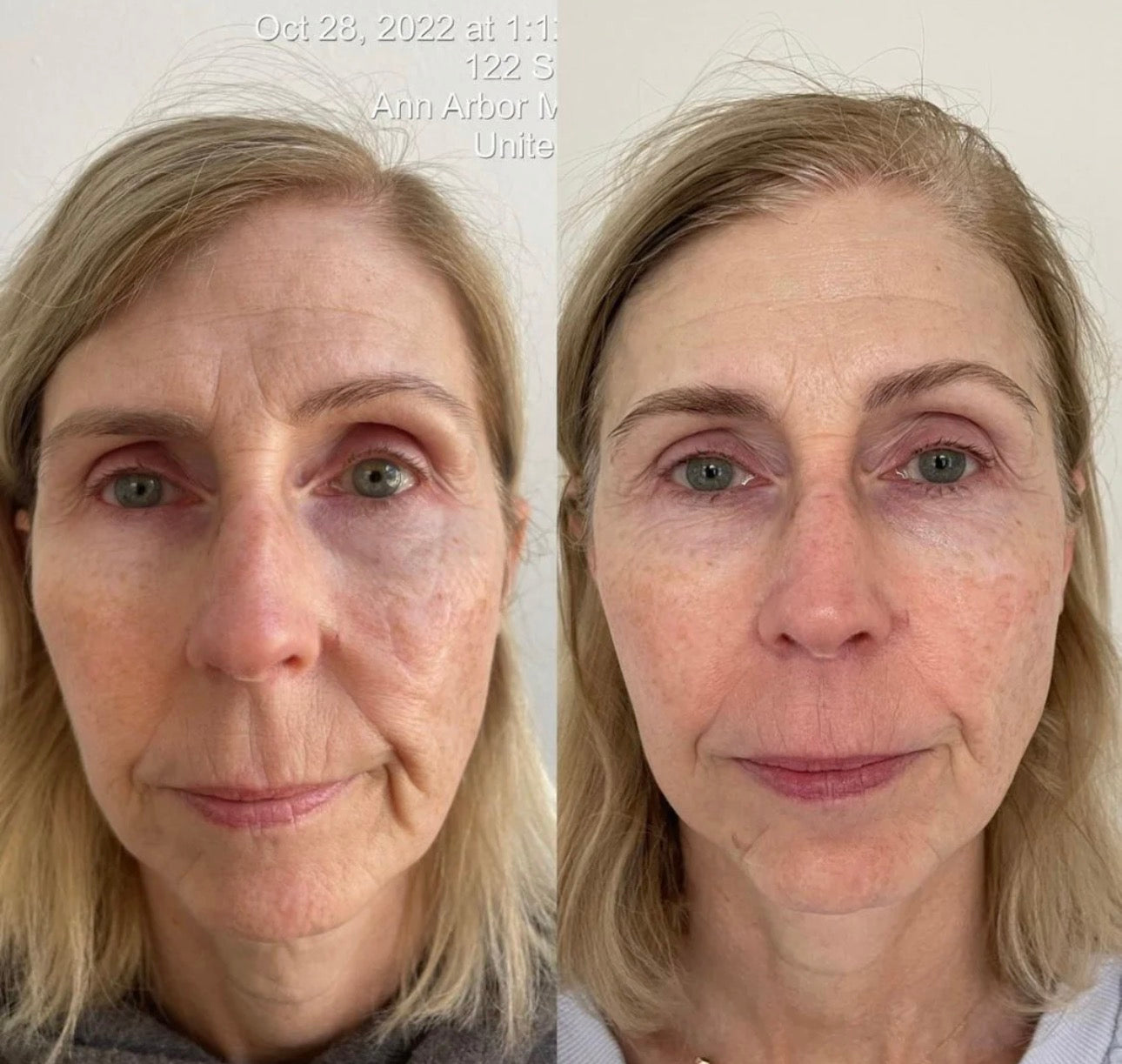 KrX Youthplex Face Lift Serum